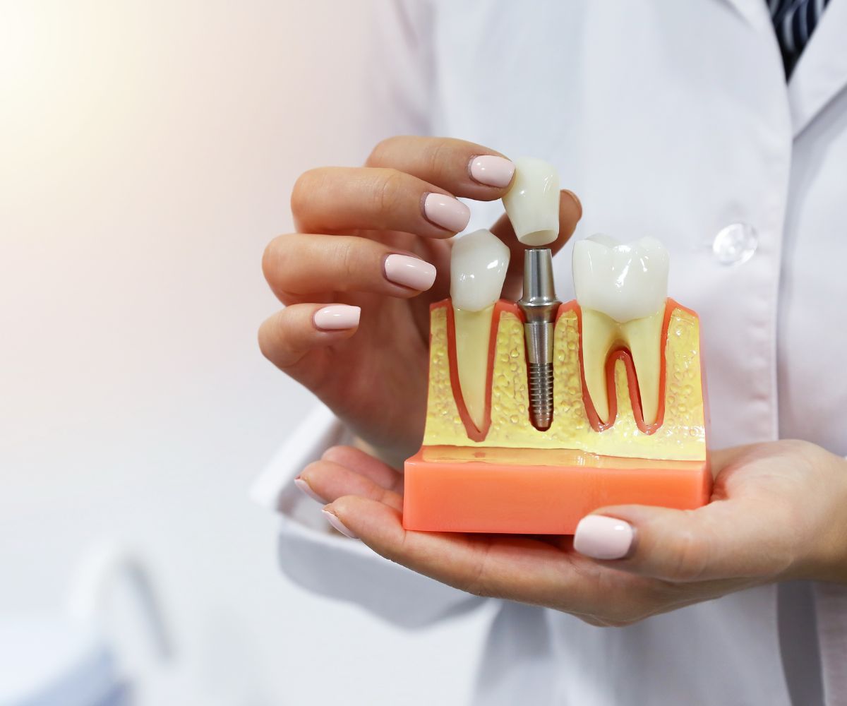 Restrições para Realizar Implante Dentário