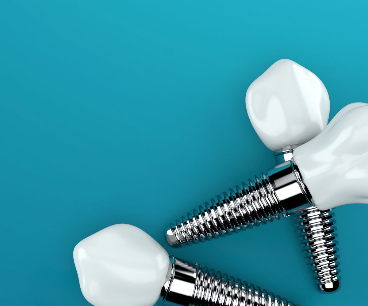 Tecnologia nos Implantes Dentários