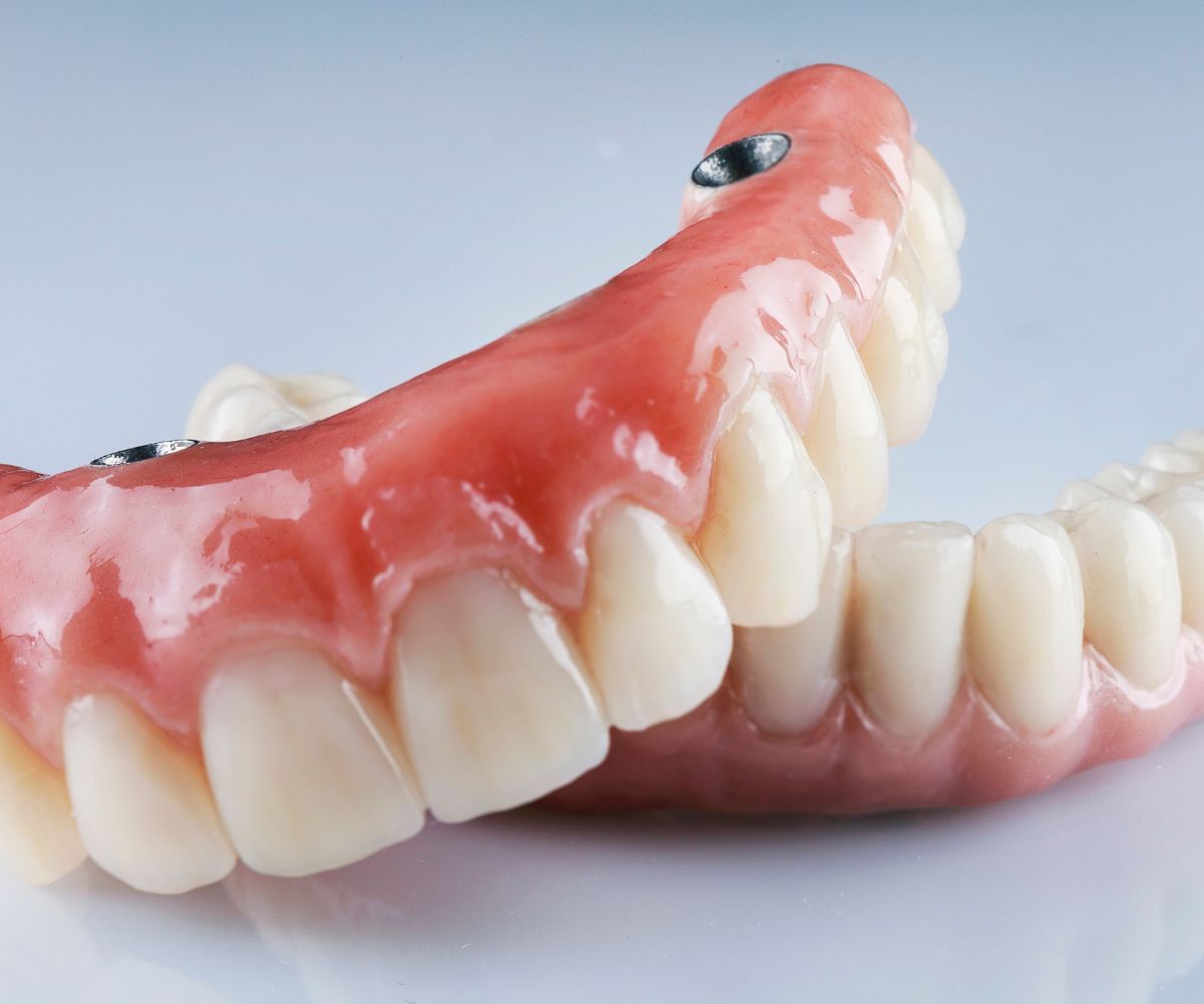 implante dentario protocolo